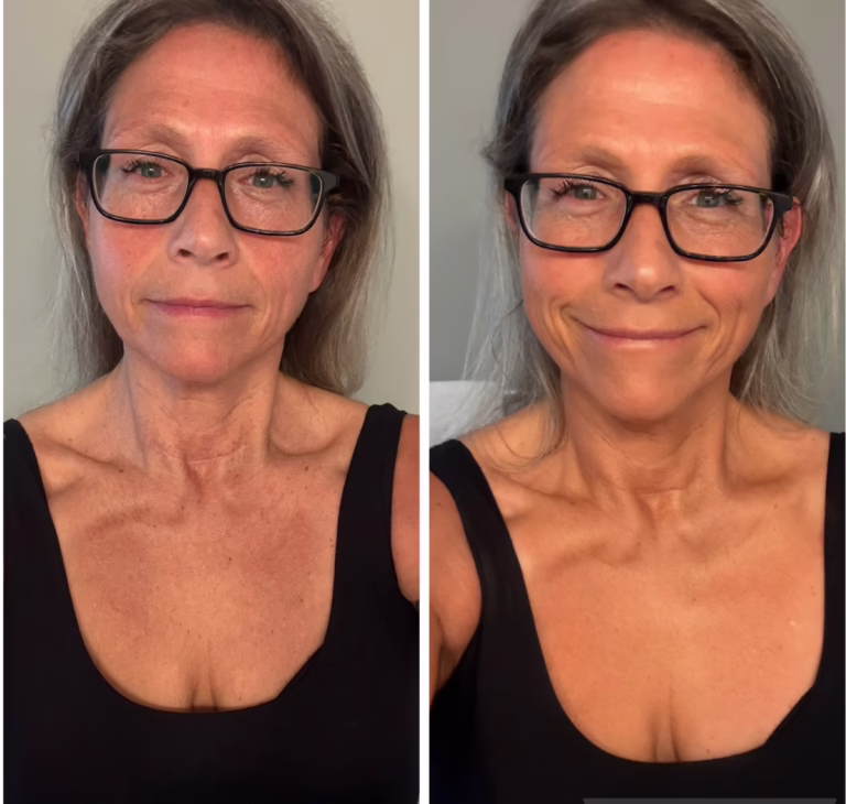 Westmore Body Coverage